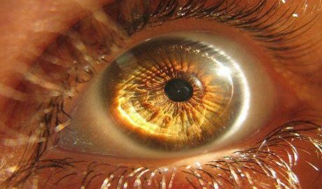 轻灵科技-爱生华硅水凝胶隐形眼镜奢侈、舒适与自由同在